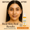 Before and after comparison of a woman using The Essentials Vitamin C Face Wash, showing visible skin glow and improved tone in 2 weeks. Bottle of face wash shown on the side with callouts: “Real Skin. Real Results.” and “Gentle on Sensitive Skin” on a soft beige background.