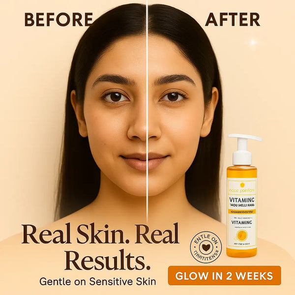 Before and after comparison of a woman using The Essentials Vitamin C Face Wash, showing visible skin glow and improved tone in 2 weeks. Bottle of face wash shown on the side with callouts: “Real Skin. Real Results.” and “Gentle on Sensitive Skin” on a soft beige background.