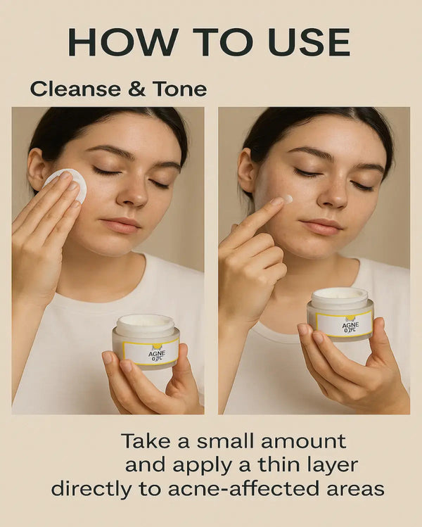 Essentials Acne Shield Gel