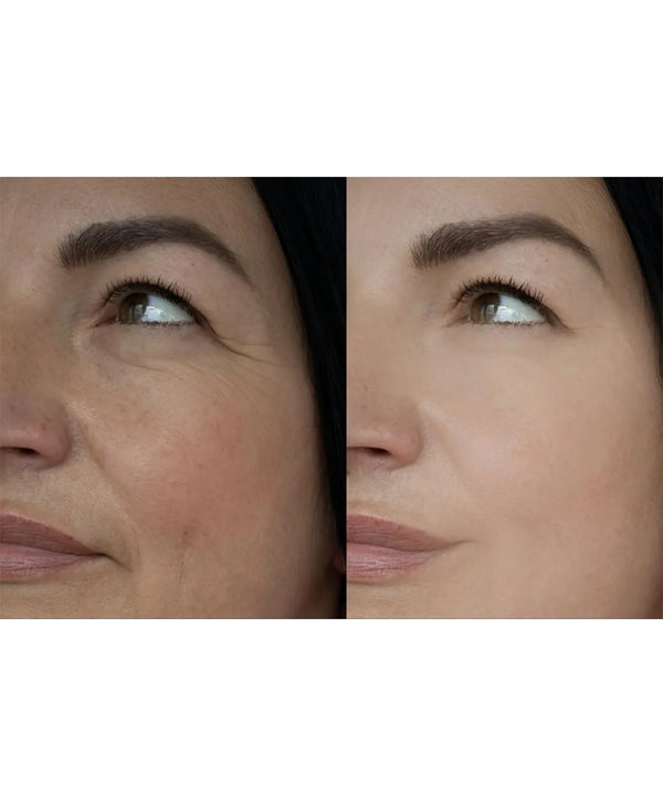 Age-Defying & Hydration Kit