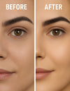 acne shield gel