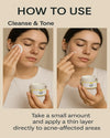 Essentials Acne Shield Gel